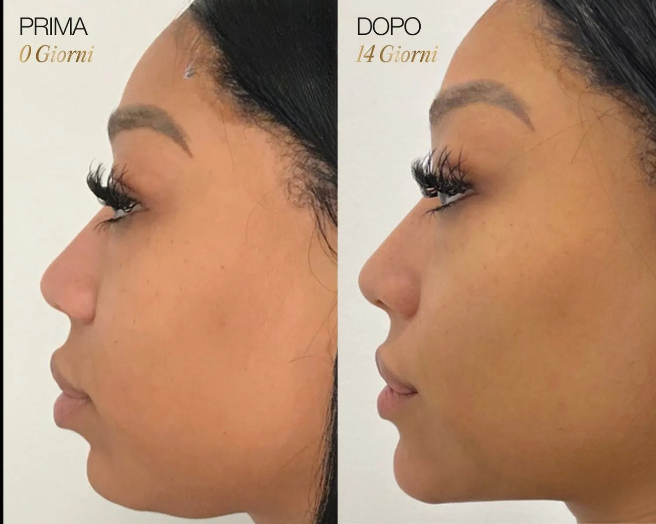 Spazzola Viso Linfodrenante