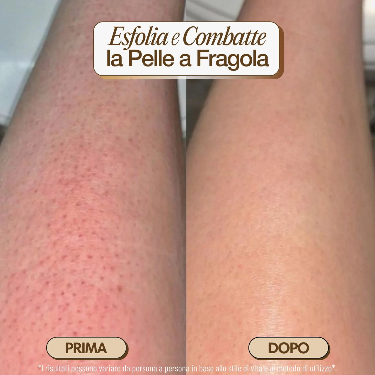 iBrushy Spazzola a Secco