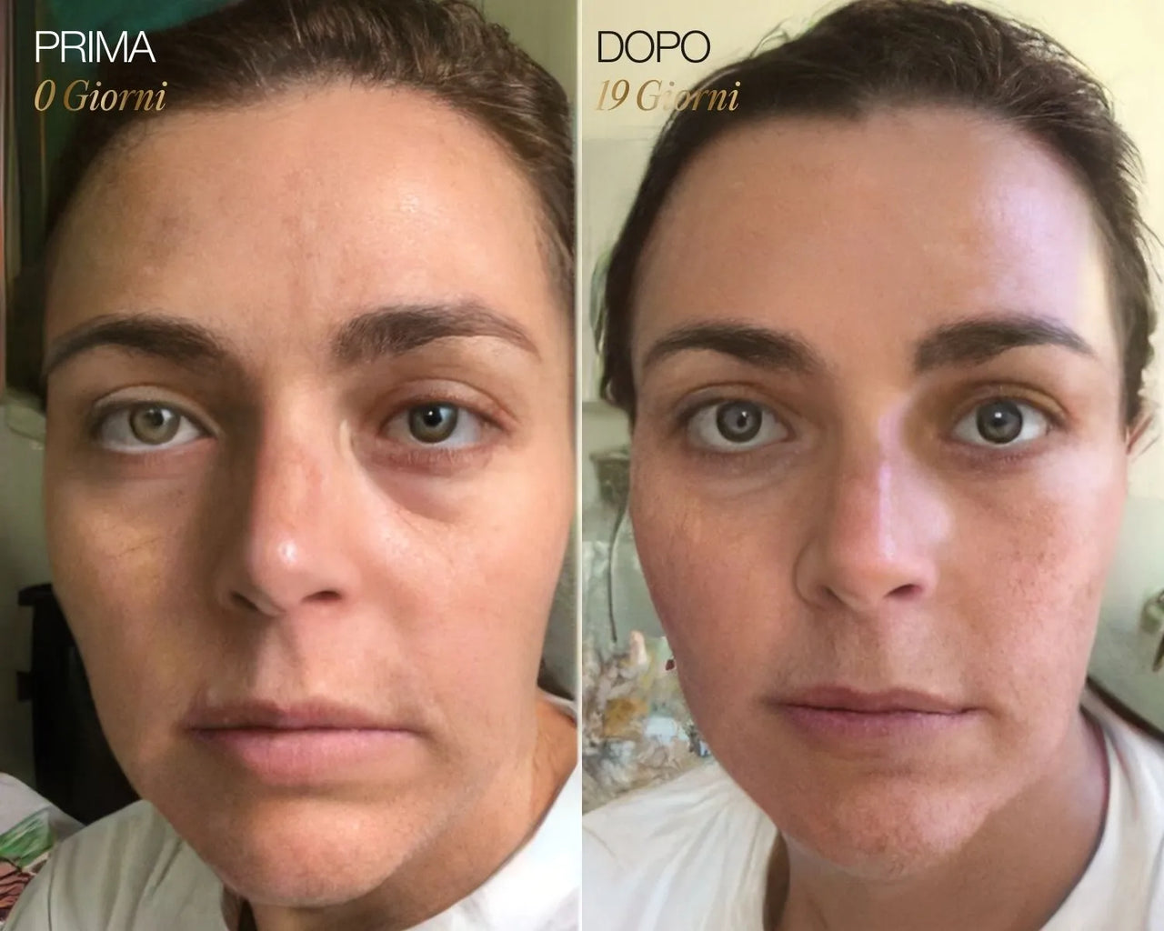 Spazzola Viso Linfodrenante