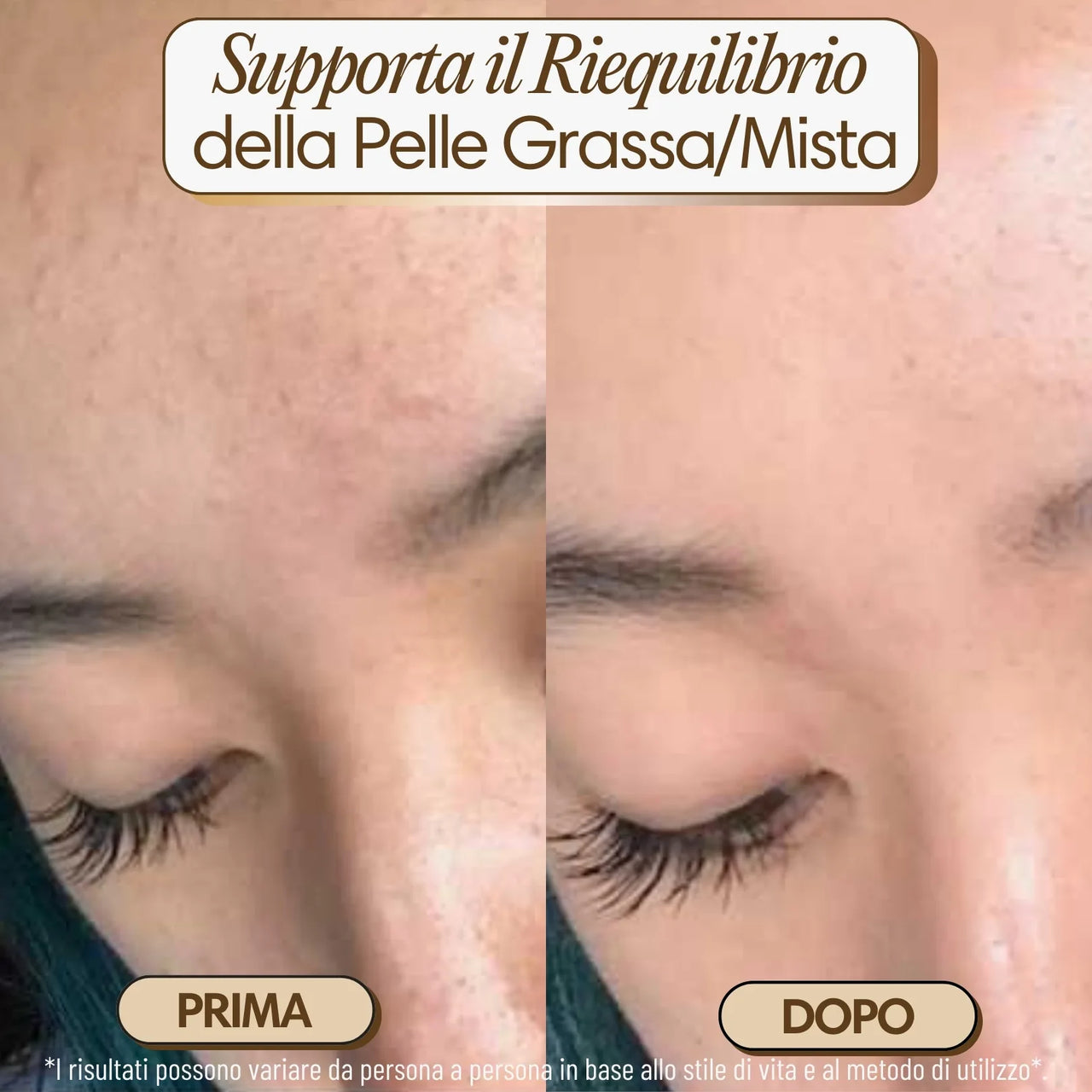 Mini iBrushy Viso