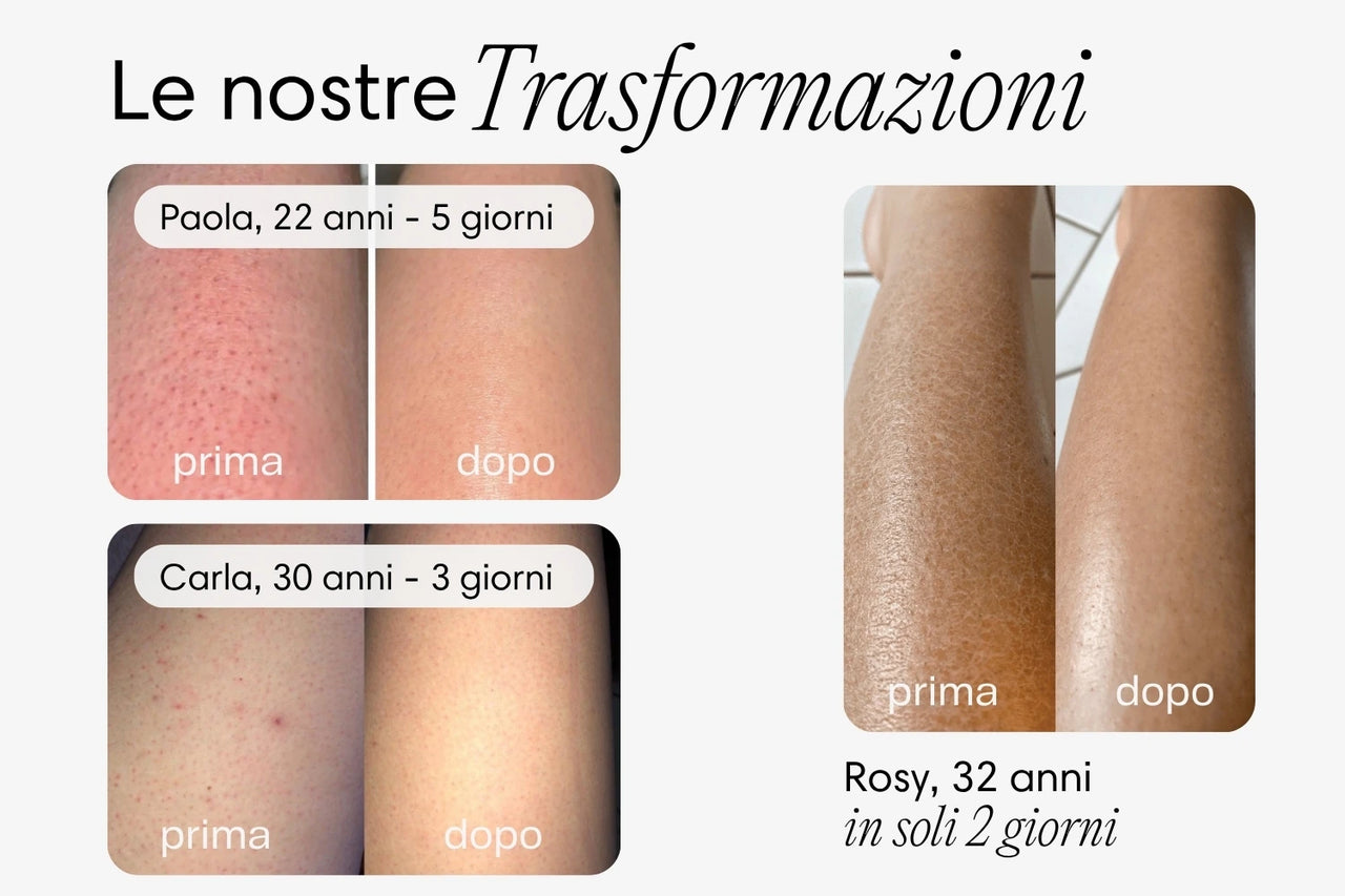 Spazzola a Secco iBrushy™